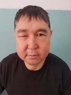 «Обмоем тебя, когда умрёшь!»: умерший от рака вор в законе Серик Голова жаловался на врачей и администрацию колонии