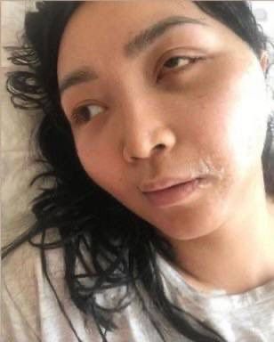 Забил жену до полусмерти и отправился на поселение: как работает «закон Салтанат»?